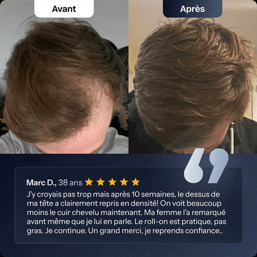 Solaz Bodywise™ - Roller Repousse Capillaire - Solaz