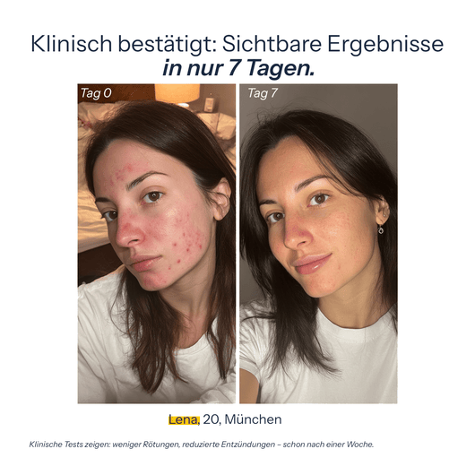 Solaz KLAR+ Cleanser - Solaz Skincare